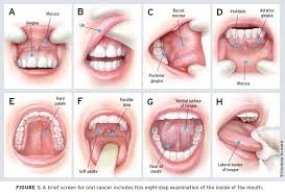 Sri Lanka&#039;s First Int&#039;l Conference on Oral Cancer begins tomorrow